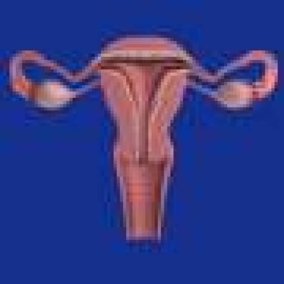  Endometriosis: Diagnosing the debilitating condition