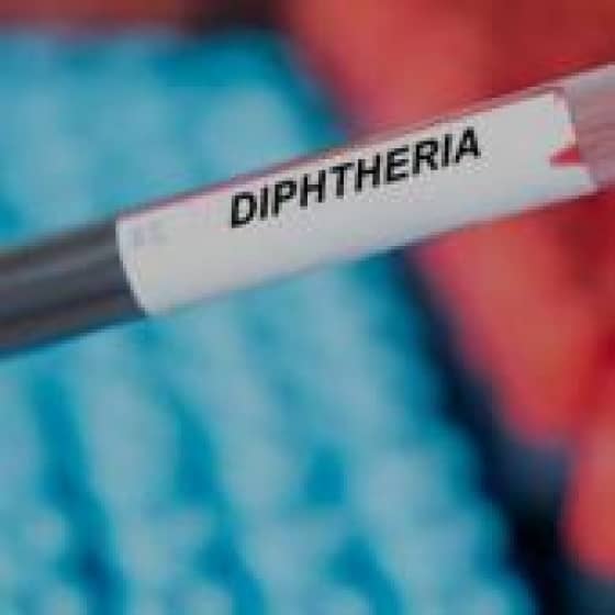 Outbreak Of Diphtheria In Jigawa Claims 10 Lives As State Records 91 Cases