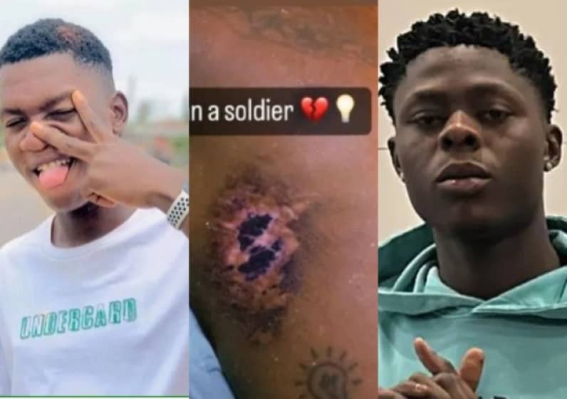  “This matter goes long oh” – OGB Recent shares new photo of huge scar on Mohbad’s body