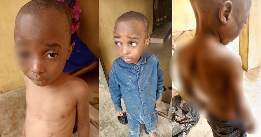  Lady cries out for help to save boy and his siblings who are allegedly being maltreated by their father